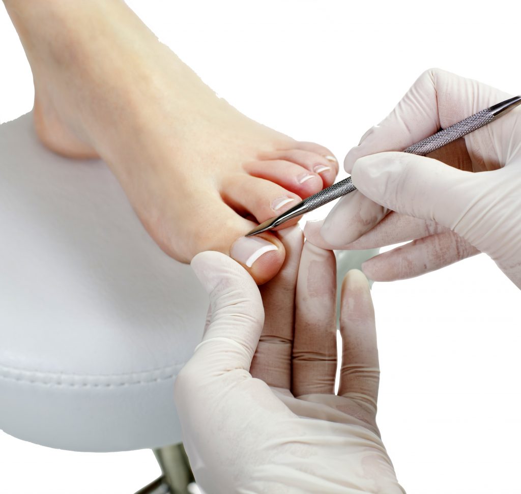Medisch pedicure Roermond